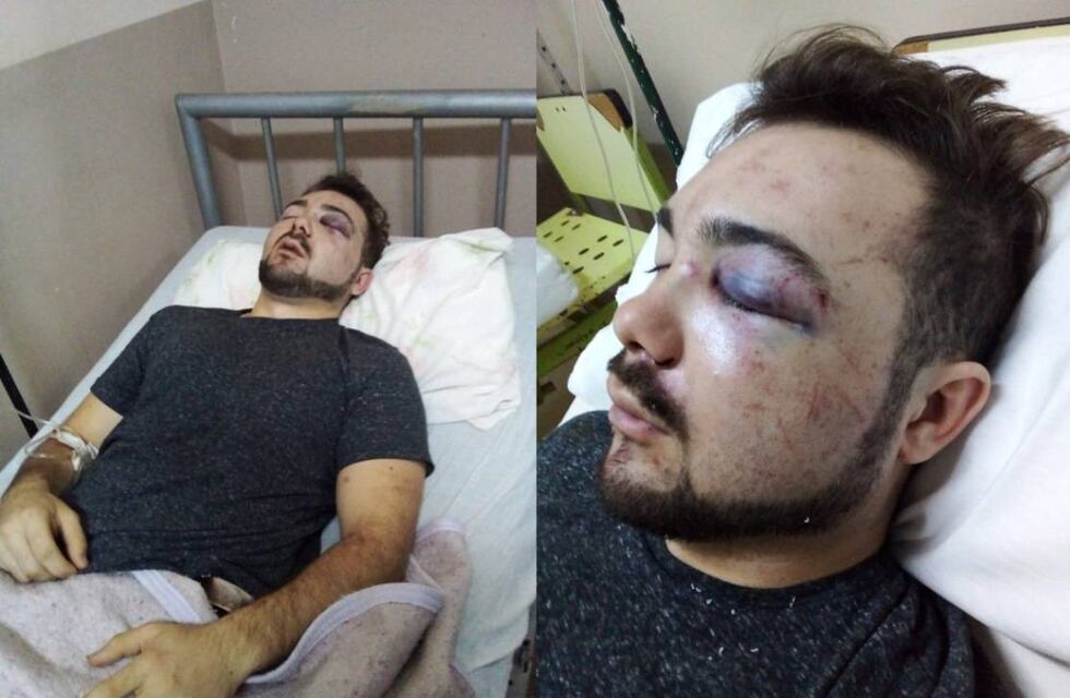 Ataque irracional: agredieron a un joven de 21 años, lo patearon y lo dejaron inconsciente de un ladrillazo en la cabeza
