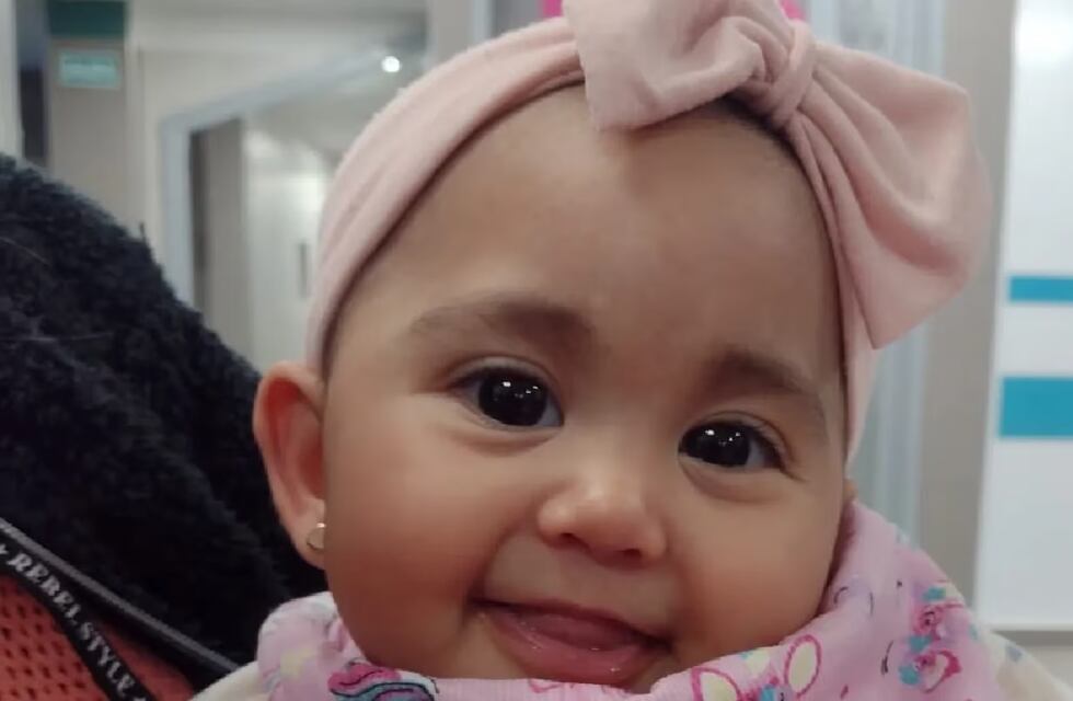 Una bebé mendocina necesita operarse urgente: “Su frente está creciendo en triángulo”