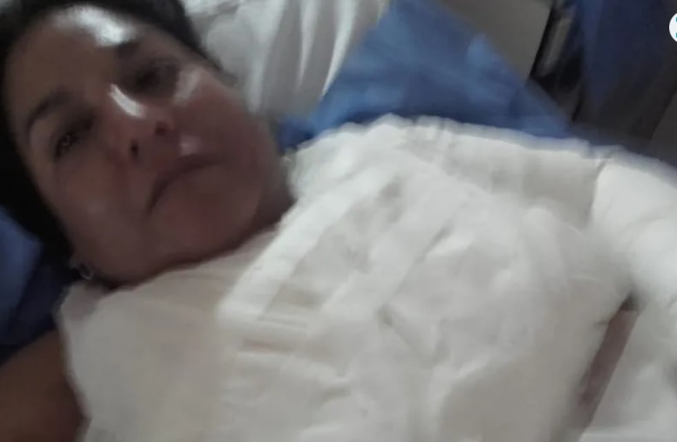Salvaje agresión de una suegra a su nuera: le arrojó una tetera con agua hirviendo