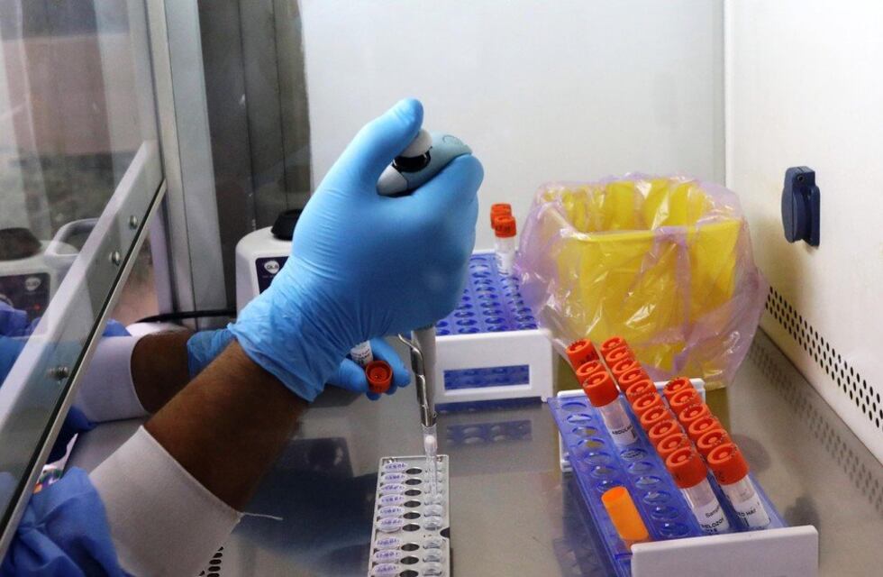 “Chapare”, el virus de transmisión humana detectado en Bolivia que genera preocupación