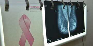 Por el mes de prevención del cáncer de mama, realizarán mamografías y testeos gratuitos. (La Voz/ Archivo)