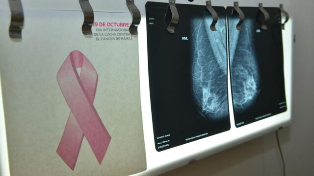 Por el mes de prevención del cáncer de mama, realizarán mamografías y testeos gratuitos. (La Voz/ Archivo)