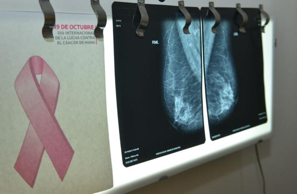 Mes del cáncer de mama: actividades, asesorías y testeos gratuitos en Córdoba