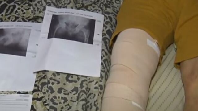 Tomás Córdoba asegura que fue víctima de una confusión, había otro paciente con el mismo apellido al que le tenían que poner una prótesis de rodilla.