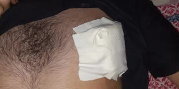 Sin mediar palabras, apuñalaron a un joven en Eldorado para robarle el celular