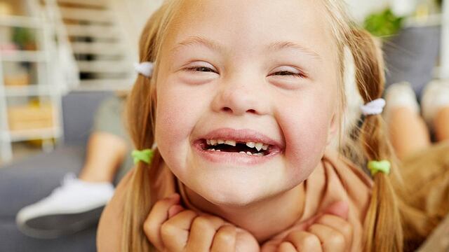 Una adecuada comprensión del síndrome de Down e intervenciones tempranas pueden mejorar la calidad de vida de niños y adultos con este diagnóstico. / Especial Profesionales y Sociedad
