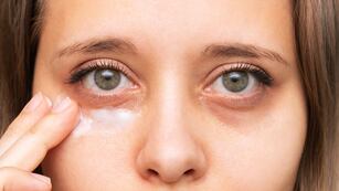 El truco del ''pellizco''.