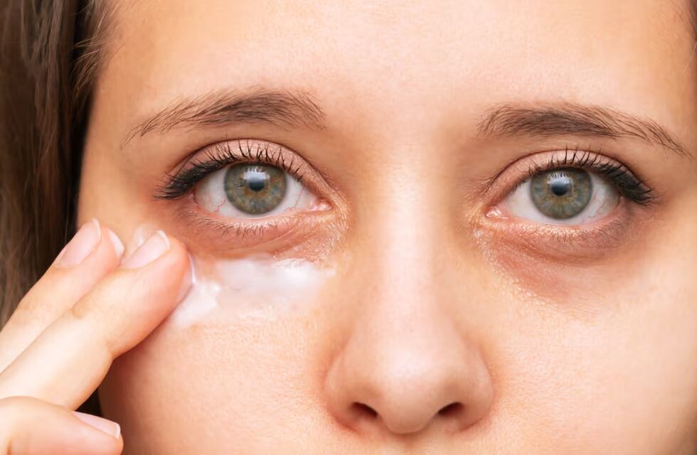 No es solo por cansancio: las ojeras podrían estar evidenciando estos problemas de salud