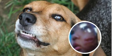Fue operada la nena de 2 años que fue mordida por un perro.