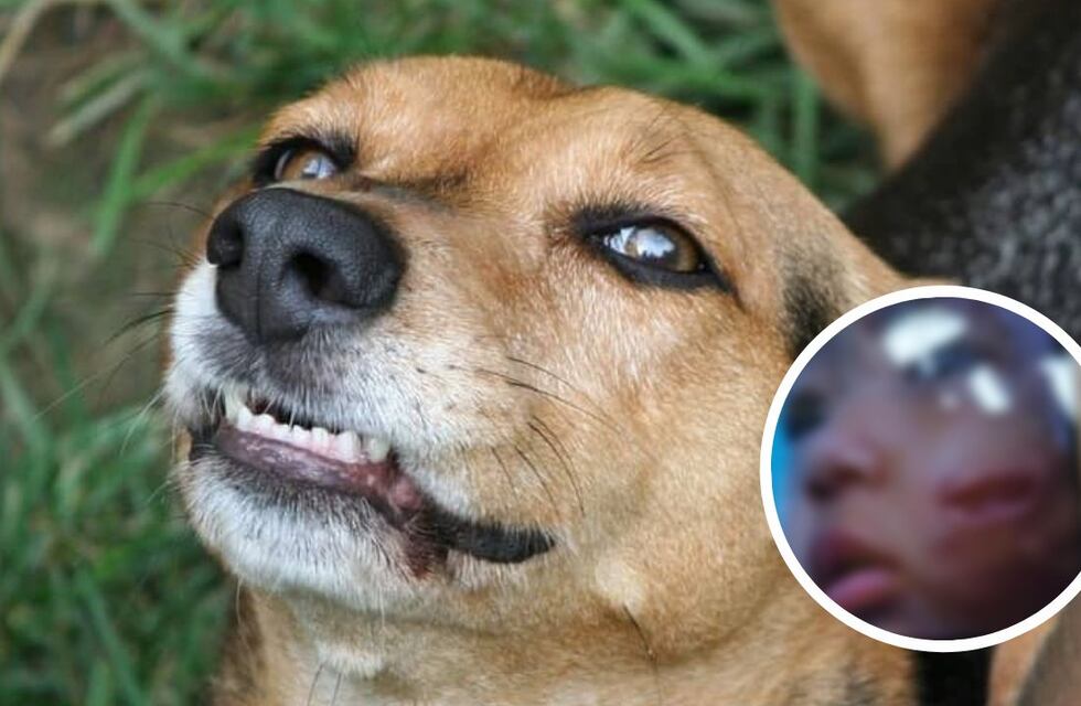 Después de cinco días: la nena mordida por un perro en Salta fue atendida por un cirujano