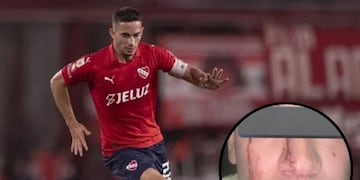 Grave denuncia contra Iván Marcone