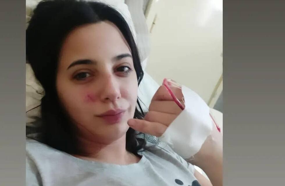 Fue atropellada en Mar del Plata y necesita conseguir 80 mil pesos para no perder su pierna