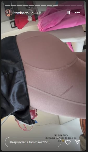 La cirugía estética de Tamara Báez