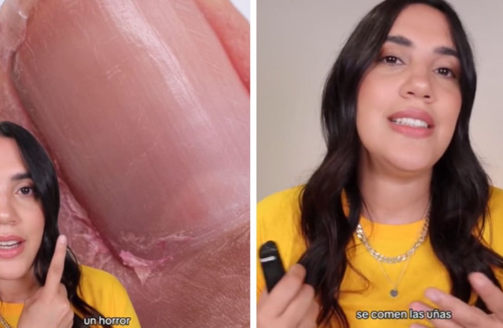 Lo recomendó Dadatina, se consigue en farmacias y es ideal para las uñas quebradizas