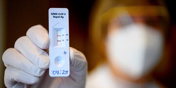 Pérez sumó 145 casos nuevos de coronavirus 
 (Laurent Gillieron/Keystone via AP)