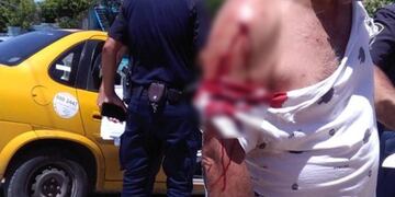 El taxista se resistió al robo y recibió puñaladas (Foto: Radio Suquía).