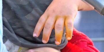 El chico de un año y 8 meses quedó consciente luego del intento de arrebato en Bolivia al 1300 bis. (Canal 3)