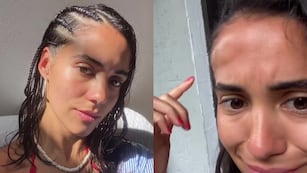 Trenzas en la playa: Por qué se hincha la cara y la cabeza y cuál es la solución