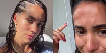 Trenzas en la playa: Por qué se hincha la cara y la cabeza y cuál es la solución