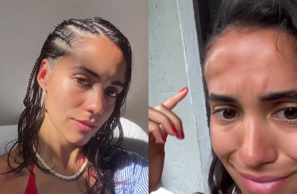 Trenzas en la playa: por qué se hincha la cara y la cabeza y cuál es la solución