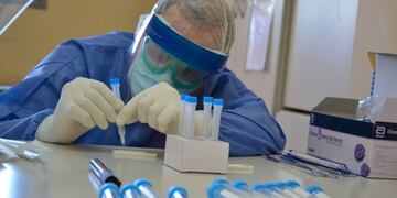 Se registró la víctima más joven de coronavirus: un paciente de 23 años / Diario Huarpe