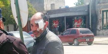 El chofer de la combi que trasladaba al Negro Videla y su banda. El cantante asegura que fue golpeado por la Policía. (Fotos gentileza Negro Videla)