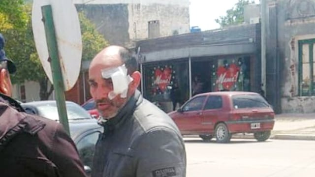 El chofer de la combi que trasladaba al Negro Videla y su banda. El cantante asegura que fue golpeado por la Policía. (Fotos gentileza Negro Videla)
