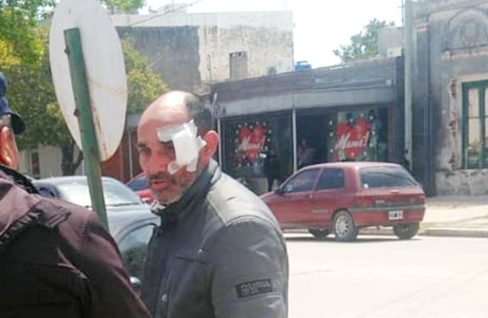 Imputaron por lesiones al policía que habría agredido al chofer del Negro Videla