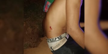 Prefectura baleó a un menor en un confuso procedimiento en Puerto Rico.