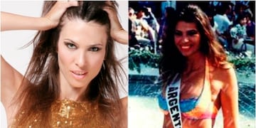 La joven fue Miss Universo Argentina. Años después, se practicó una cirugía estética que la llevó a la muerte.