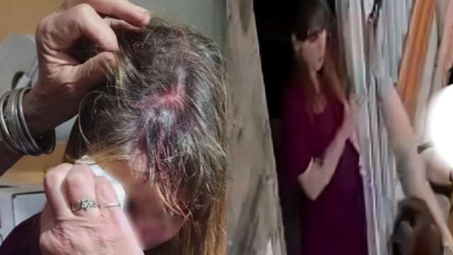 Atacaron a una veterinaria en Córdoba.