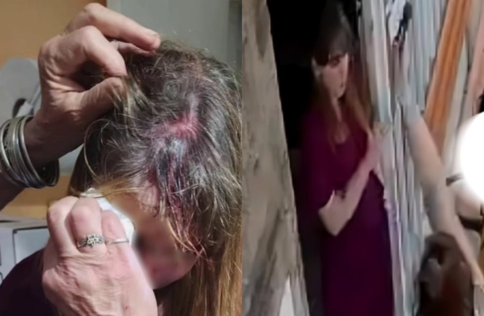 “Me intentó matar”: el brutal ataque sufrió una veterinaria en Córdoba