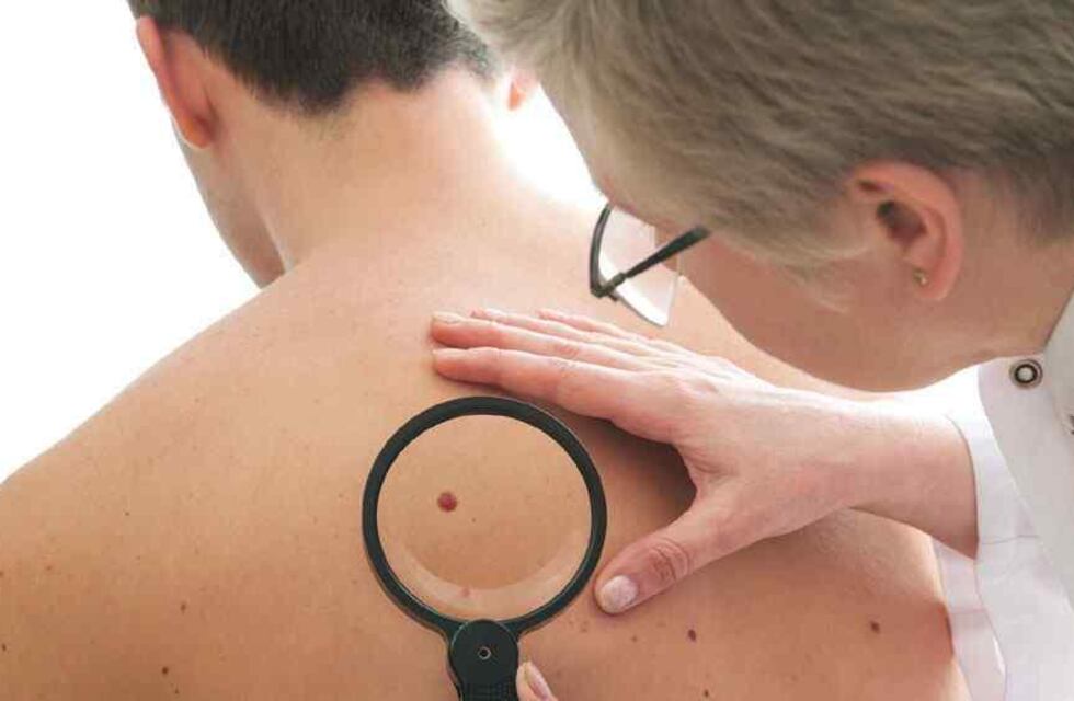 Controles gratuitos para detectar cáncer de piel el hospital Schestakow