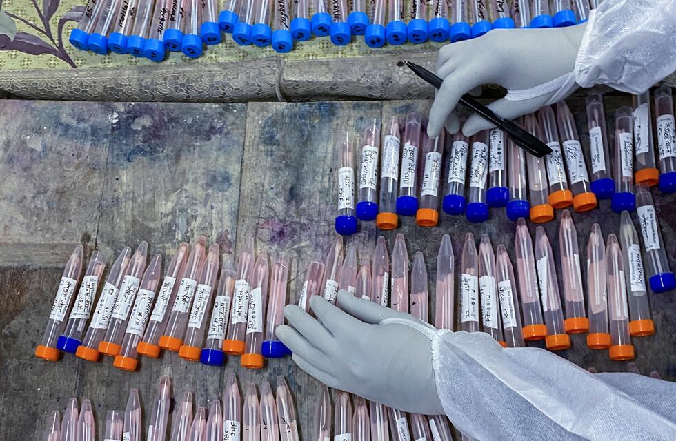 77 nuevos casos de coronavirus se registraron este lunes en San Luis