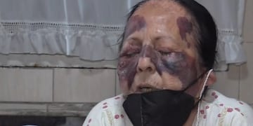 Olga, la jubilada asaltada, relata cómo fue el ataque que sufrió en su casa mientras dormía.