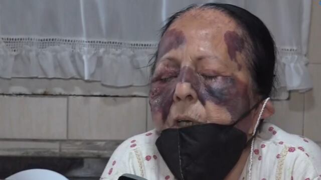 Olga, la jubilada asaltada, relata cómo fue el ataque que sufrió en su casa mientras dormía.