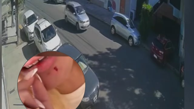 El violento ataque de un vecino a una joven en Villa del Parque por un auto mal estacionado: “Me pegó en la cara”.