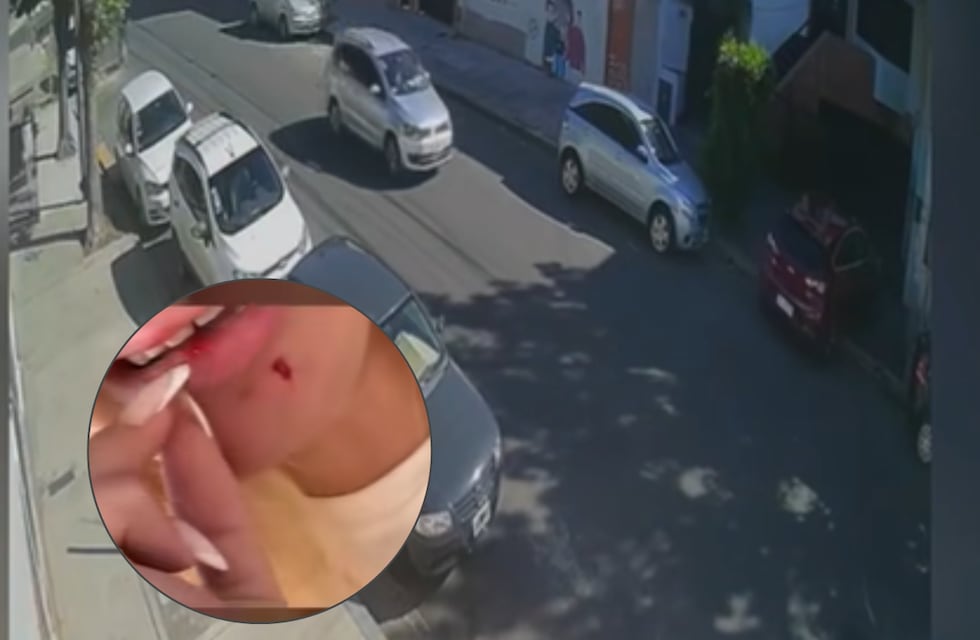 El violento ataque de un vecino a una joven en Villa del Parque por un auto mal estacionado: “Me pegó en la cara”