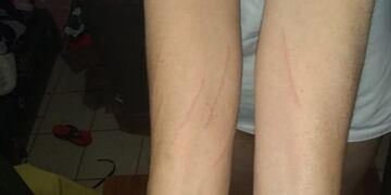 Una mujer denuncia violencia física por parte de sus vecinos en Puerto Iguazú.