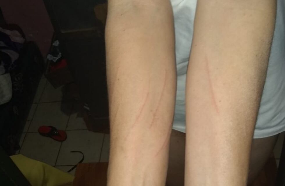 Una mujer denuncia violencia física por parte de sus vecinos en Puerto Iguazú