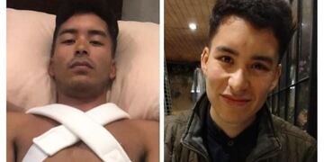 Martín tiene una fractura y debe ser intervenido quirúrgicamente, por eso necesita volver a Córdoba.