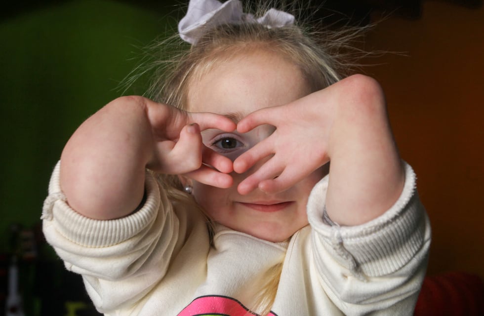 “Todo por Juanita”, la nena de 4 años que necesita viajar a España para ser operada