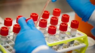 La OMS anunció que vigila una nueva variante de coronavirus