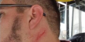 Chofer agredido por dos pasajeros en Córdoba.