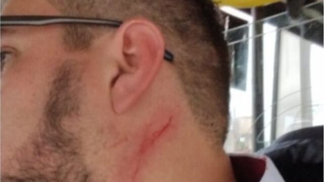 Chofer agredido por dos pasajeros en Córdoba.