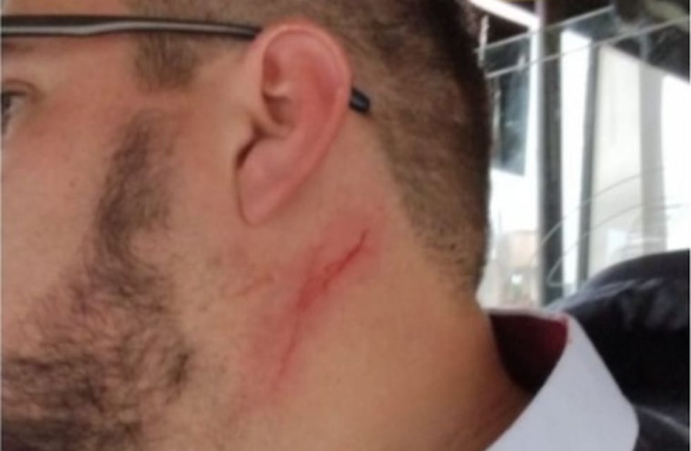 Un chofer de Ersa denunció que pasajeros le pusieron un cuchillo en el cuello