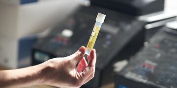 Muestra de orina (Imagen ilustrativa)