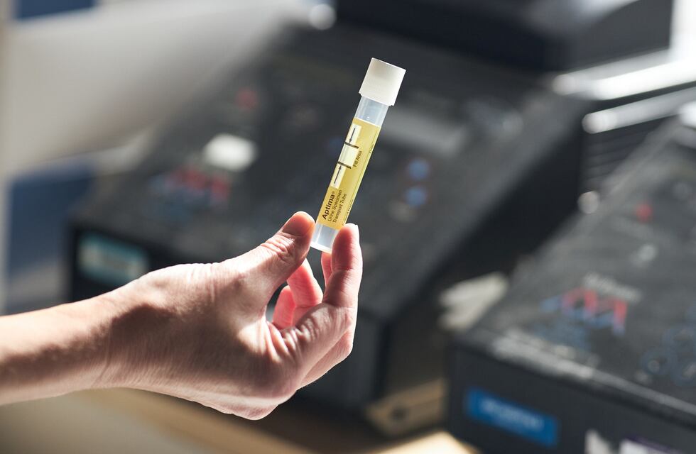 Comienza en Jujuy una novedosa campaña de recolección de orina de mujeres