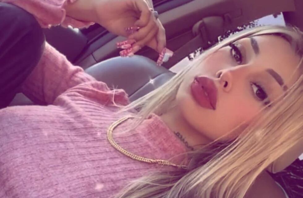 Tamara Báez, la novia de L-Gante, se hizo un nuevo retoque en la cara y va por más