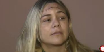 Córdoba: la balearon en un robo, aún tiene el proyectil en la cabeza y teme volver a su casa (El Doce).